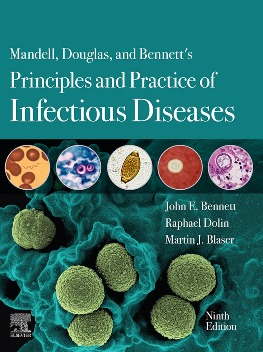 mandell-douglas-and-bennett-s-principles-and-practice-of-infectious-diseases-9th-edition-2-volume-set-69498b3bc220d.jpg